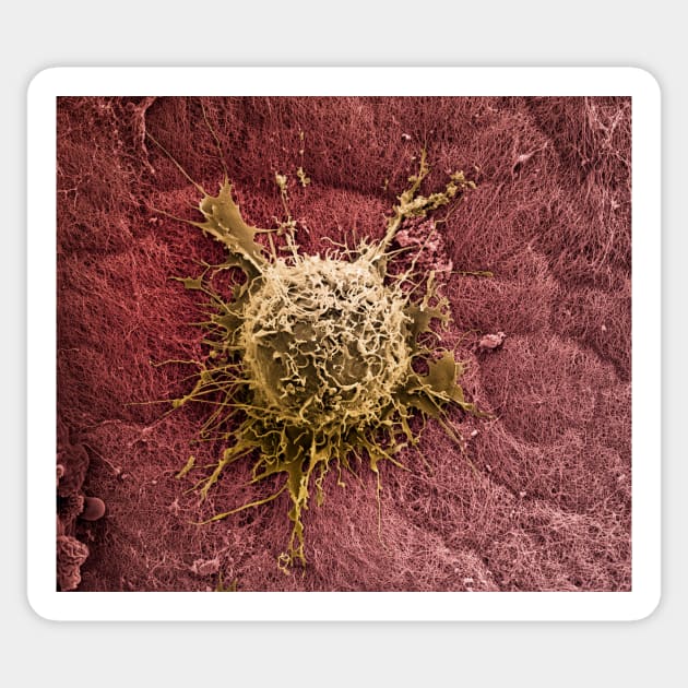 Bone marrow stem cell on cartilage, SEM (C019/7222) Sticker by SciencePhoto